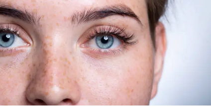 LASIK eye surgery